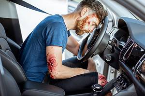 Most common car accident injuries